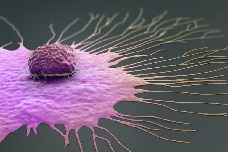 Breast Cancer Cells Consume Their Surroundings to Survive January 16, 2024 Credit: Christoph Burgstedt/Science Photo Library/Getty Images