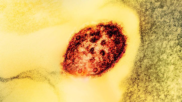 Transmission electron microscopy image of measles virus (red) منصة اكس - @NIAIDNews
