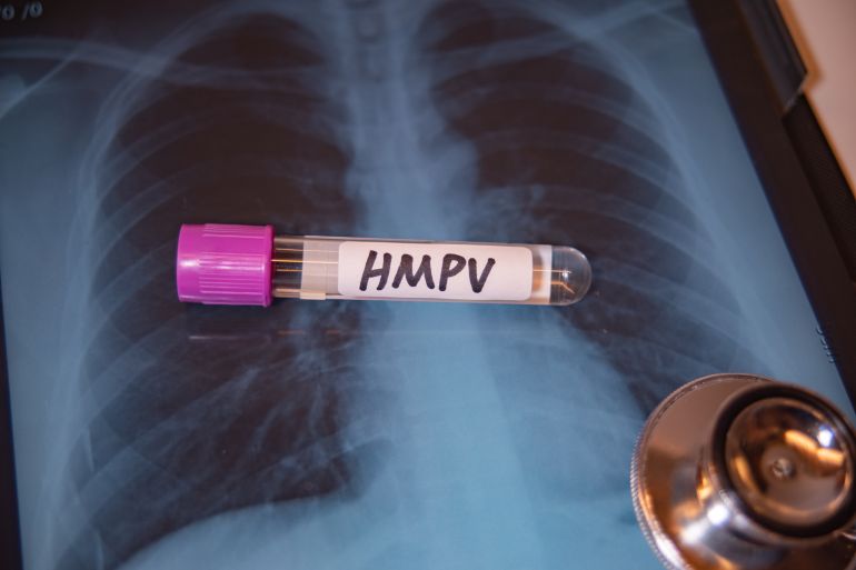 Background of Human Metapneumovirus (HMPV) RT-PCR Kit ,Medical health concept